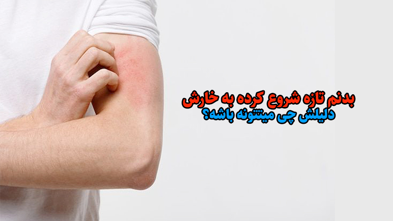 بدنم تازه شروع کرده به خارش دلیلش چی میتونه باشه؟