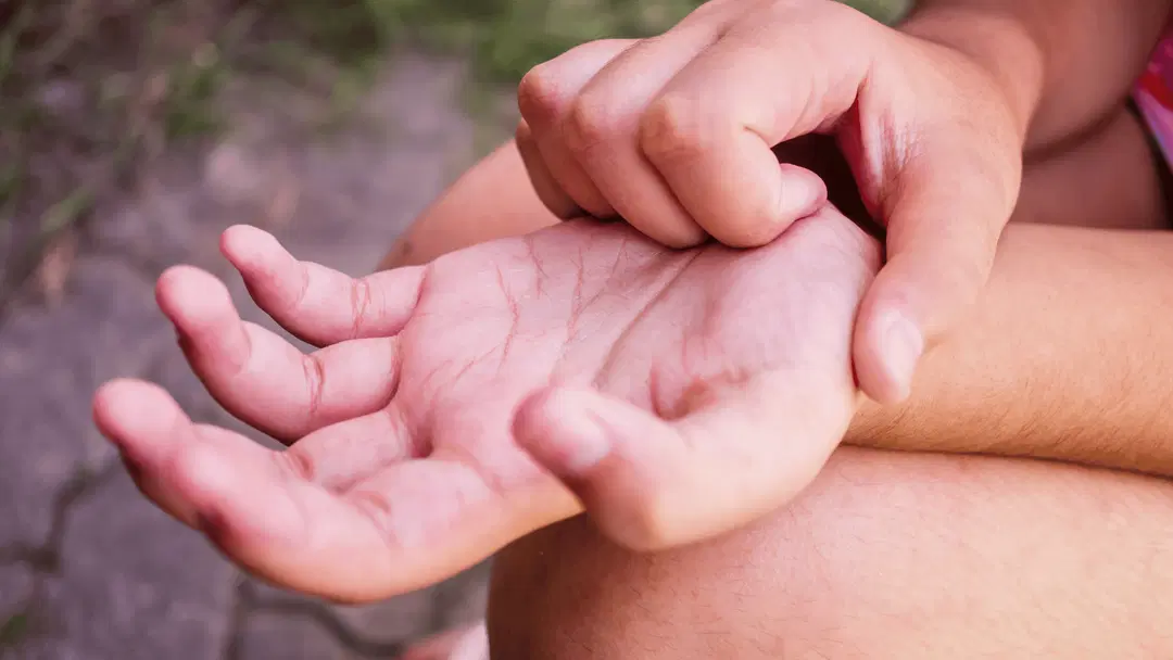 آیا خاراندن کف دست نشانه پولدار شدن یا ضرر مالی است؟